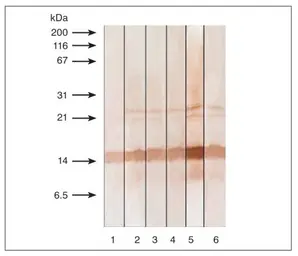 Anti-Calcitonin antibody [16B5] used in Western Blot (WB). GTX11493